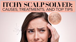 The Real Causes of Itchy Scalp—and How to Stop It [upl. by Euqnimod]