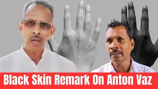 Black Skin Remark On MLA Anton VazNarayan Naik Message To All Goans [upl. by Nadaba646]