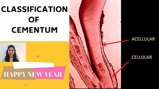 CEMENTUM  PART II II Classification of Cementum [upl. by Azerila967]