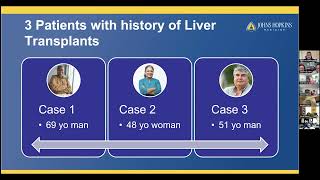 Navigating TransplantRelated Diabetes Dr Nestoras Mathioudakis Johns Hopkins Medicine 81224 [upl. by Bridget993]