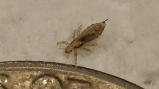 How Much Do You Know About Head Lice Pediculosis Capitis The Rosh Reveal Podcast Ep 28 [upl. by Kittie]