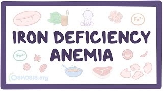 Iron deficiency anemia  an Osmosis Preview [upl. by Annohsed225]