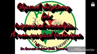 Glycerol rhizotomy for trigeminal neuralgia A non surgical techniqueMuga narambin athirvu vali [upl. by Rengia]