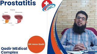 Prostatitis  Dr imran Qadir [upl. by Yedorb]