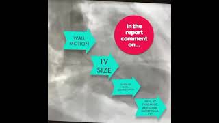 Basics of Ventriculography [upl. by Fryd]