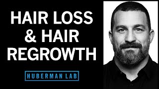 The Science of Healthy Hair Hair Loss and How to Regrow Hair  Huberman Lab Podcast [upl. by Marla668]