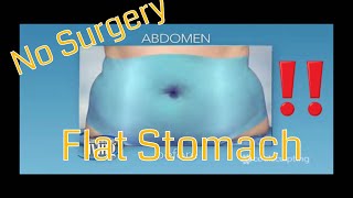 How I got a Flat Stomach in a week with cool sculpting  NO SURGERY [upl. by Euqirne]