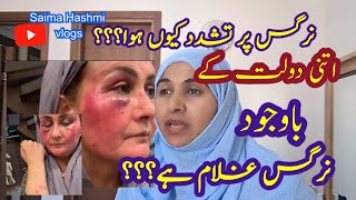 NARGIS PAR TASHADUD BEMAR ZEHNIYATSAIMA HASHMI VLOGS shashmi0087 humanity iftikharahmedusmani [upl. by Inoliel]