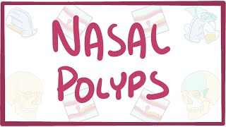 Nasal Polyps  causes symptoms diagnosis treatment pathology [upl. by Normac]