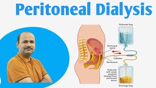 Peritoneal Dialysis  by Dr Bhojoo Mal [upl. by Zenobia]