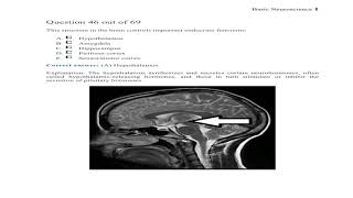 SCE MRCP Questions Update in Neurology From BoardVitals [upl. by Eltsirhc]