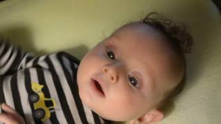 How to put a contact lens in a baby  with explanation [upl. by Tjaden736]