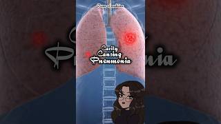 CavityCausing Pneumonia causativeorganisms shorts medicalshorts [upl. by Hnah]