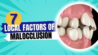 Etiology of malocclusion quotLocal factors of malocclusionquot  Orthodontics [upl. by Pontius]