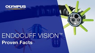 Decrease in Risk of Cancer through ENDOCUFF VISION™ [upl. by Ailb]