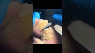 Charming Pedicure Video  Remove Dead Skin [upl. by Dillon]