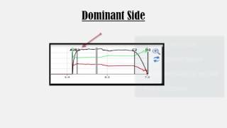 Evaluating Closures with TScan Part 3 [upl. by Eceirtal]