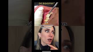 A gengiva descolou do dente 😱😰 já me segue pra isso nunca acontecer com você 😅 [upl. by Seiter]