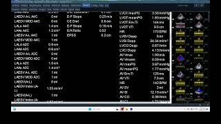 IQ 311 HEMODYNAMIC ECHOPAC ANALYSIS ECHOCARDIOGRAPHY CBDS REPORT [upl. by Byrle]