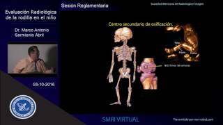 Evaluación Radiológica de a rodilla en el niño [upl. by Kowtko758]