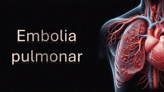 Embolia pulmonar [upl. by Conah497]