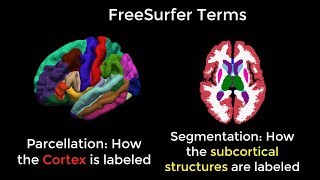 FreeSurfer 1 Introduction [upl. by Aurilia667]