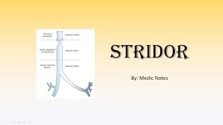 Stridor  acutechronic causes Bernoulli principle clinical features investigations management [upl. by Jacy]