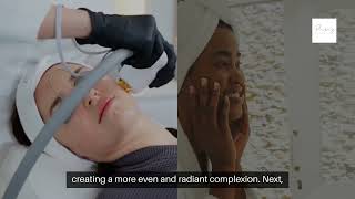 Venus Lift TriBella Treatment in prospertexas  The Ultimate 3in1 Facial Rejuvenation [upl. by Jonme]