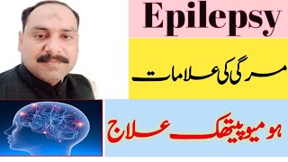 Epilepsy ka ilajHomeopathic MedicineDr Sajjad Homeopathic Treatment of Epilepsy [upl. by Orvie49]