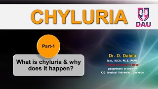 CHYLURIA  What is chyluria amp why does it happen [upl. by Ailgna731]