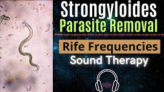 Rife Frequencies for Strongyloides Parasite Removal [upl. by Ursulette]