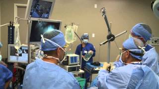 Shoulder Surgery Arthroscopy OR Setup and Patient Positioning [upl. by Willman168]