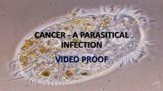 VIDEO PROOF CANCER IS CAUSED BY PARASITES [upl. by Savart]