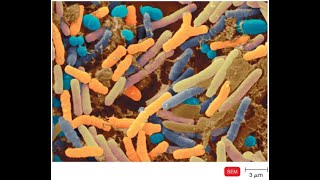 11 Introduction to Microbiology [upl. by Frayne]