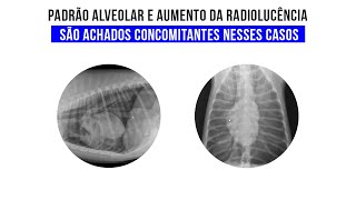 Caso Clinico Pneumomediastino e pneumotórax [upl. by Adnwahsal926]