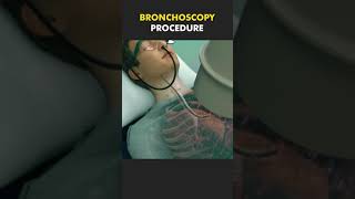 BRONCHOSCOPEviralvideo [upl. by Maurilla]