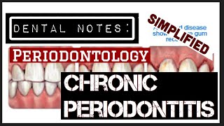 CHRONIC PERIODONTITIS II DENTAL NOTES II PERIODONTOLOGY II STUDY WITH ME [upl. by Vidovic]