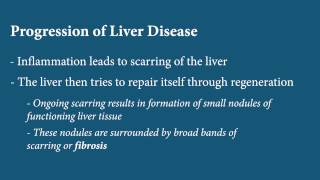 Liver Disease  Fibrosis [upl. by Ahsemot549]