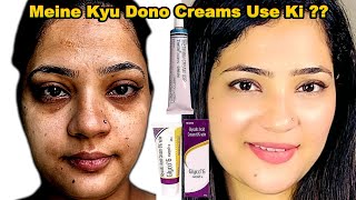 Glyco 6 vs Tretinoin Why I Decided to Use Both for Maximum Results  Indian Youtuber Anmol [upl. by Juanne]