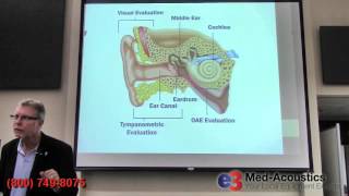 Auditory Evoked Potentials  OtoAcoustic Emissions OAE [upl. by Atnuahsal]