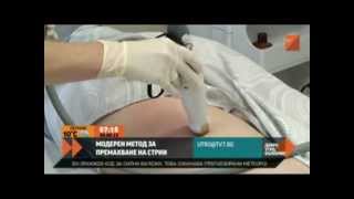 Как се махат стрии  Stretch marks striae removing treatment in Hill Clinic Sofia Bulgaria [upl. by Eerat239]