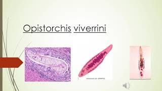 Clonorchis sinensis y opistorchis viverrini [upl. by Ellemrac]