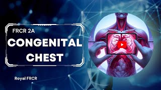 6  Chest Imaging for FRCR [upl. by Innis203]