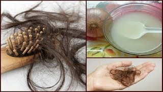 क्या प्याज का रस लगाने पर भी बाल झड़ रहे हैं  तो जरूर देखें  how to grow hair faster [upl. by Reynolds]