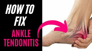 How To Treat Ankle Tendonitis [upl. by Anawat]