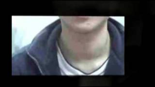 Thyroid Goiter and Thyroid Nodules Cases  part 1 [upl. by Airolg]