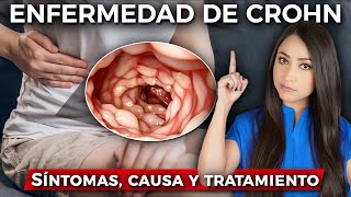 ¿Qué es la ENFERMEDAD DE CROHN👩🏻‍⚕️ l Causa SÍNTOMAS y tratamiento drapauzuniga [upl. by Simetra]