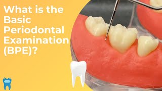 Basic Periodontal Examination BPE  What Why and How [upl. by Kannry]