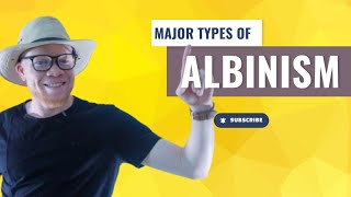 Two Major Types of Albinism [upl. by Hersh]