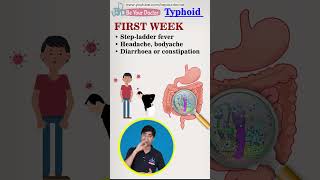 Typhoid causes  Typhoid symptoms  Typhoid treatment  Typhoid short [upl. by Ardis882]